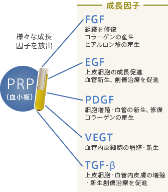 PRP (血小板血漿注入療法)